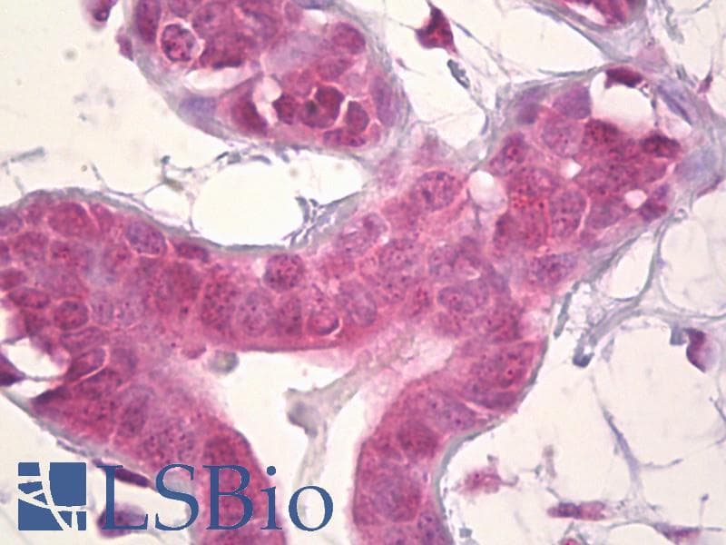 IHC-plus™ DLX5 Antibody (aa91-140)