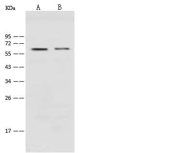 PODXL / Podocalyxin Antibody