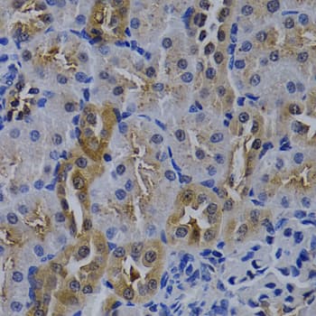 IHC-plus™ Polyclonal Rabbit anti-Human TNFRSF6B / DCR3 Antibody (IHC, WB)