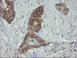 ROMO1 Antibody (clone OTI2C12)