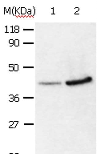 Polyclonal Rabbit anti-Human ANXA2 / Annexin A2 Antibody (IHC, WB)