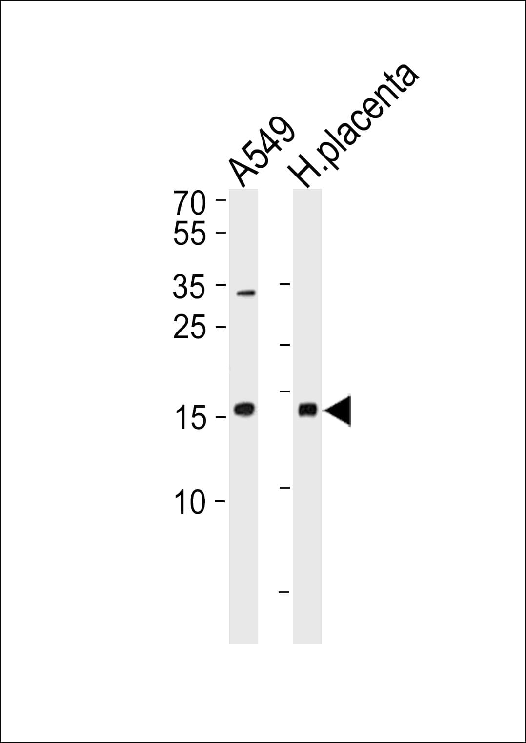NME1 / NM23 Antibody (aa29-57)