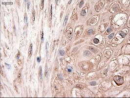 PTCH1 / Patched 1 Antibody (clone OTI5C7)