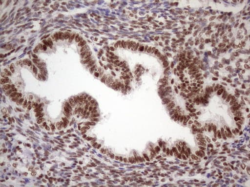 TP53BP1 / 53BP1 Antibody (aa1-300, clone OTI2H6)