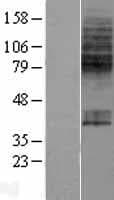 SLC23A1 / SVCT1 Protein (Over-Expression Lysate Myc-DDK (Flag))