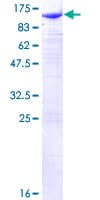 Human CTNNB1 / Beta Catenin Protein (Recombinant GST)