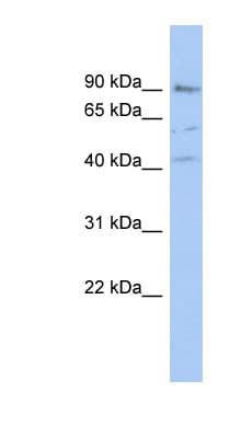 PARP12 Antibody (C-Terminus)