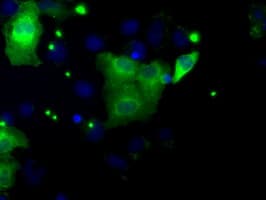 DAPK2 / DAP Kinase 2 Antibody (clone OTI1B10)