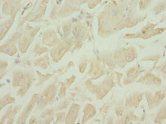DRAM2 Antibody