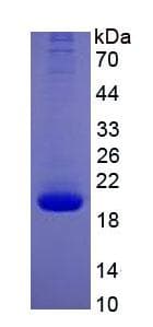 Human IL-10 Protein (Recombinant His, N-Terminal)