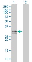 Monoclonal Mouse anti-Human NT5E / eNT / CD73 Antibody (clone 4C4-2B5, WB)