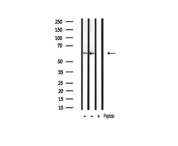 PRKAA1 / AMPK Alpha 1 Antibody (phospho-Ser485,pSer491)