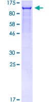 Human SATB1 Protein (Recombinant GST)