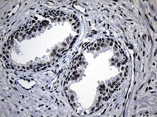 ELL / MEN Antibody (aa302-621, clone OTI2H7)