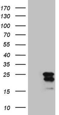 GLOD2 / MCEE Antibody (clone OTI9E12)
