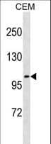 Polyclonal Rabbit anti-Human UNC5H3 / UNC5C Antibody (aa88-117, WB)