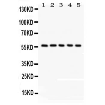 Polyclonal Rabbit anti-Human OASIS / CREB3L1 Antibody (aa1-204, WB)