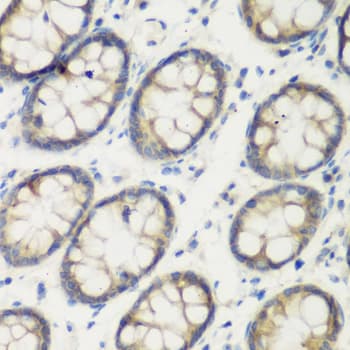 TGM5 / Transglutaminase 5 Antibody