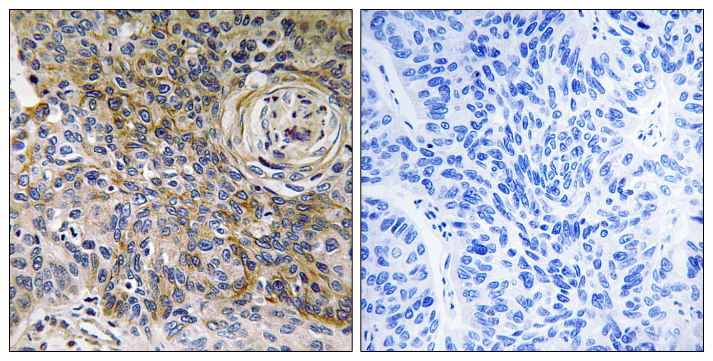 Basigin / Emmprin / CD147 Antibody (aa336-385)