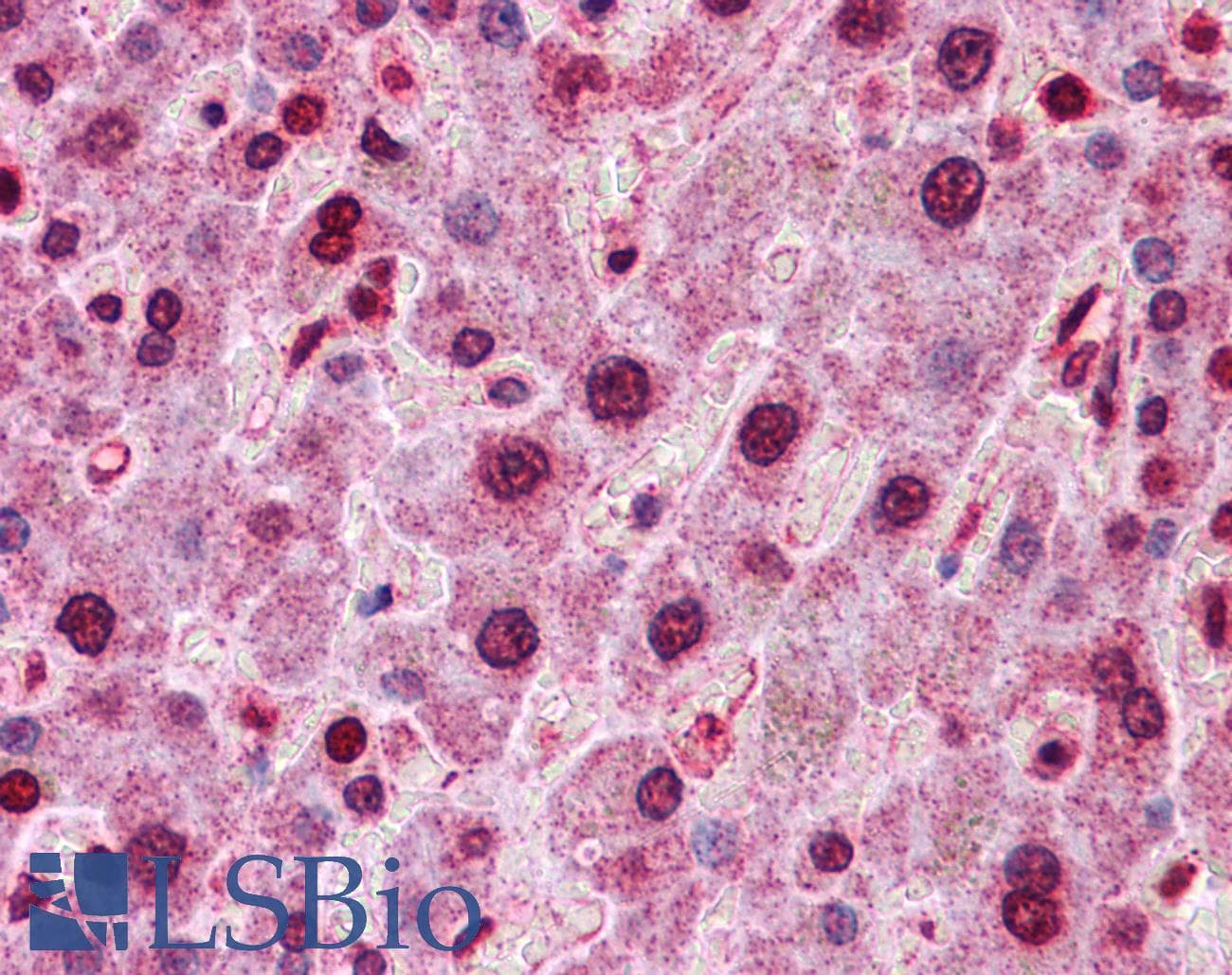 HNF4A / HNF4 Antibody (C-Terminus)