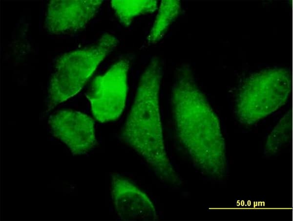 Monoclonal Mouse anti-Human CHUK / IKKA / IKK Alpha Antibody (clone 2G4, IF, WB)