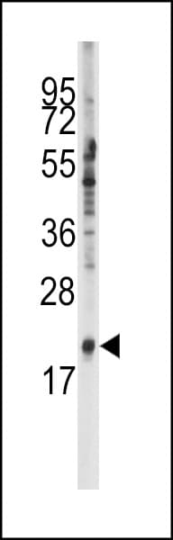 Polyclonal Rabbit anti-Human SNRPC / U1C Antibody (aa133-159, IHC, WB)