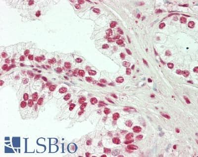 Polyclonal Rabbit anti-Human HDAC1 Antibody (IHC, WB)