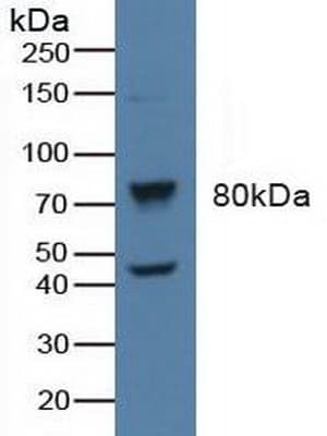 ADRBK1 / GRK2 Antibody (aa398-640, APC)