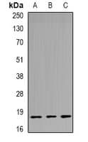Polyclonal Rabbit anti-Human TPPP3 Antibody (IHC, WB)