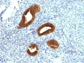 KRT19 / CK19 / Cytokeratin 19 Antibody (clone KRT19/799)