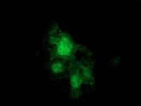 CTNNB1 / Beta Catenin Antibody (clone OTI5D2)