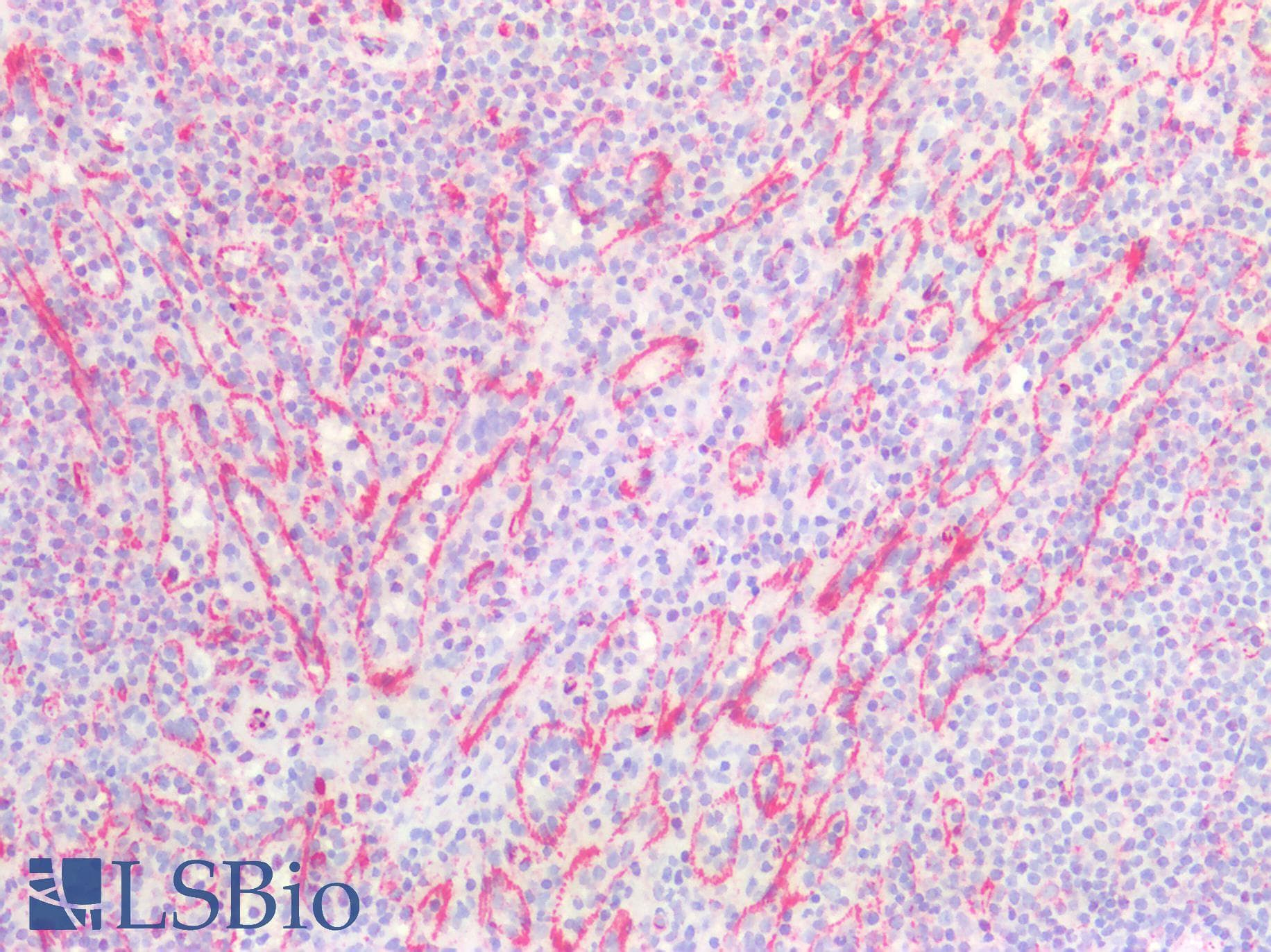 PathPlus™ Vimentin Antibody (clone AT5H8)