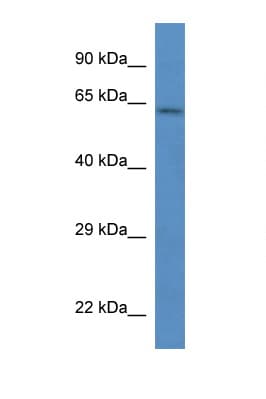 Polyclonal Rabbit anti-Rat PAK4 Antibody (aa23-72, WB)