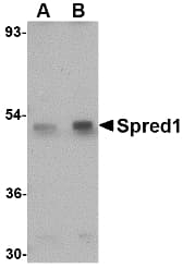 Polyclonal Rabbit anti-Human SPRED1 Antibody (IHC, WB)