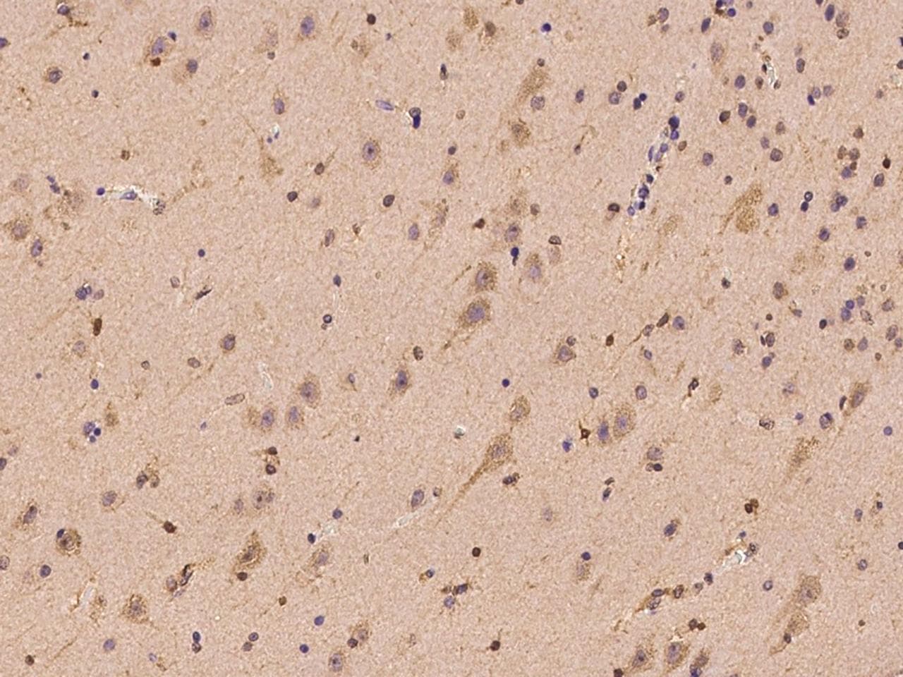 Polyclonal Rabbit anti-Human TRAK1 Antibody (IHC)