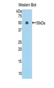 ESM1 / Endocan Antibody (aa22-184)