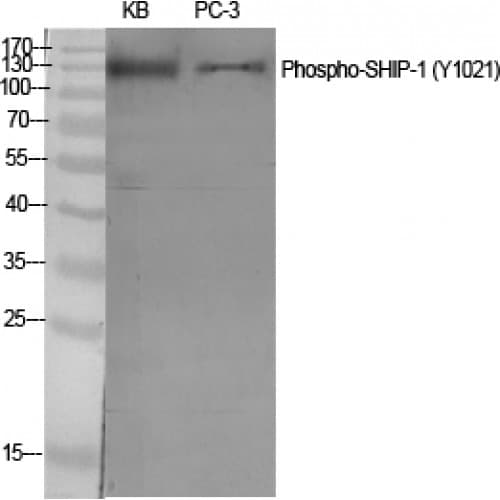 INPP5D / SHIP1 / SHIP Antibody (960-1040 aa)