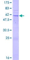 Human ART5 Protein (Recombinant GST)