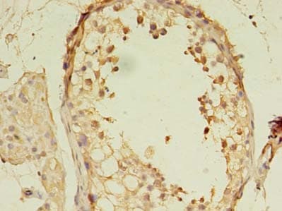 MORC2 Antibody