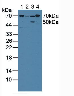 CYPOR / POR Antibody (aa77-518)