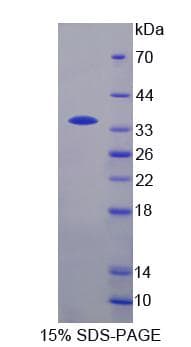 Human TCEA3 Protein (Recombinant)