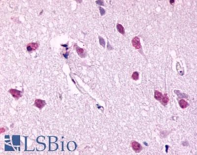 PathPlus™ Polyclonal Rabbit anti-Human BDKRB2/Bradykinin B2 Receptor Antibody (C-Terminus, IHC)