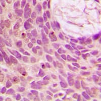 SENP1 Antibody (N-Terminus)