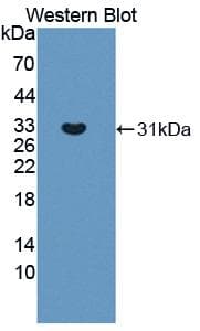TYK2 Antibody (aa667-914, Biotin)