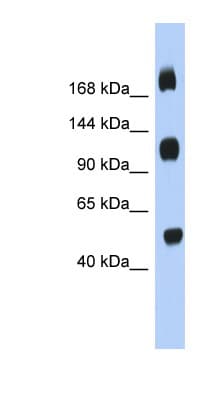 Polyclonal Rabbit anti-Human C2orf55 Antibody (aa827-876, WB)