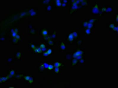 Polyclonal Rabbit anti-Human ZDHHC23 Antibody (IHC, WB)