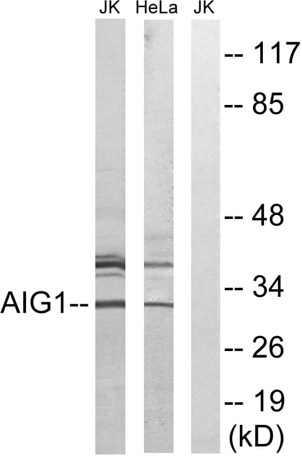 AIG1 Antibody (aa196-245)