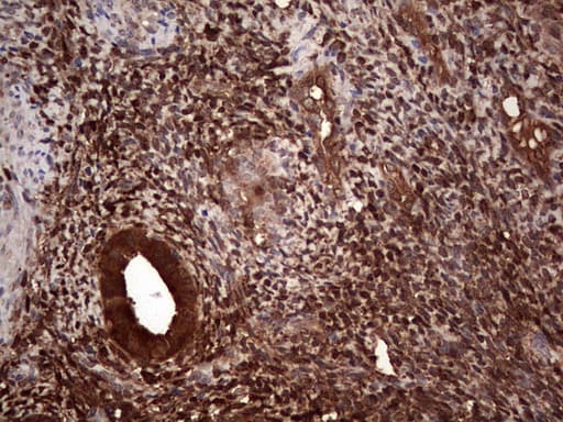LGALS3 / Galectin 3 Antibody (clone OTI7G9, Carrier-free)