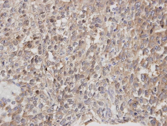 DOCK180 / DOCK1 Antibody (aa1802-1865)