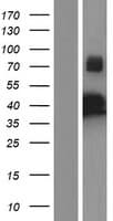 IKBKG / NEMO / IKK Gamma Protein (Over-Expression Lysate Myc-DDK (Flag))